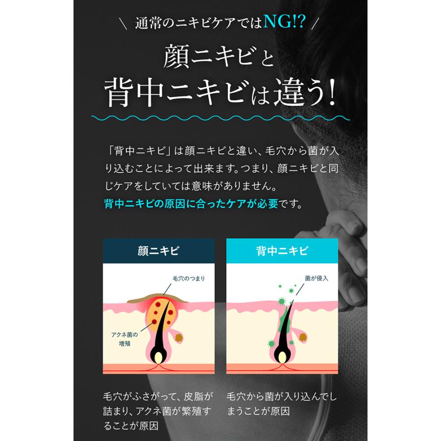 SIAQL（シアクル） ニキビケア 背中 美白 ゲルクリーム ＼3本セット