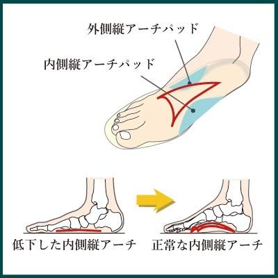 インソールプロ 扁平足 対策 中敷き インソール 衝撃吸収 偏平足 開帳足 土踏まず レディース｜shoesfit｜07