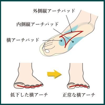 インソールプロ 外反母趾 対策 中敷き インソール 衝撃吸収 内反小趾 メンズ 0003 Shoesfit Com 通販 Yahoo ショッピング