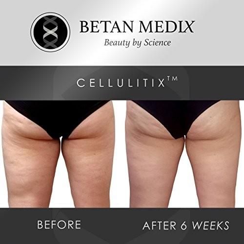 セルライト除去クリーム マッサージャー 大腿部 臀部用cellulitixセルライトリムーバー アジポスリム カフェイン配合 大腿部と臀部の肌を引 S 0318 Shokoland 通販 Yahoo ショッピング