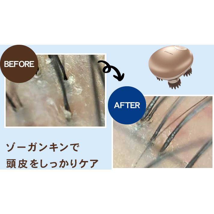 ゾーガンキンスカルプ EMS ヘッドスパ ZOGANKIN スカルプブラシ ゾーガンキンスカルプ CL-ZKS EMS ヘッドスパ ZOGANKIN 頭皮ブラシ
