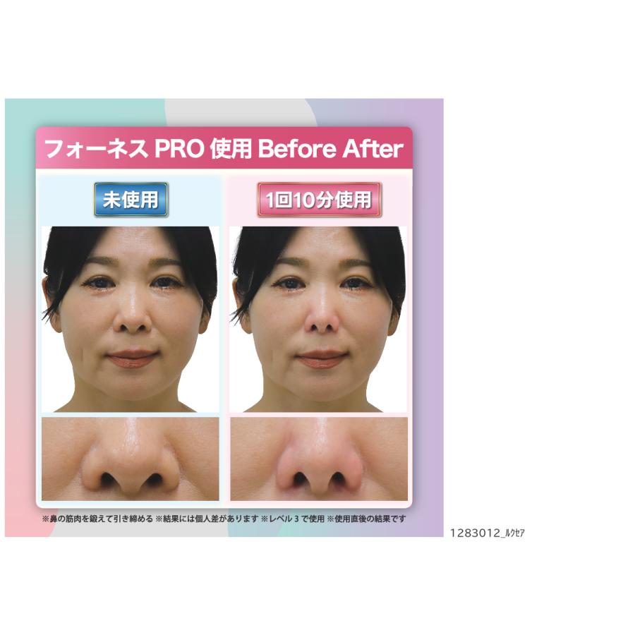 LUXCEAR（ルクセア） 鼻専用美顔器 ルクセアフォーネスPRO ルクセ