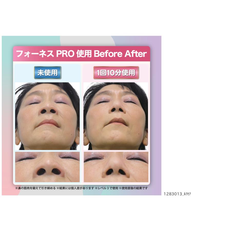 LUXCEAR（ルクセア） 鼻専用美顔器 ルクセアフォーネスPRO ルクセ