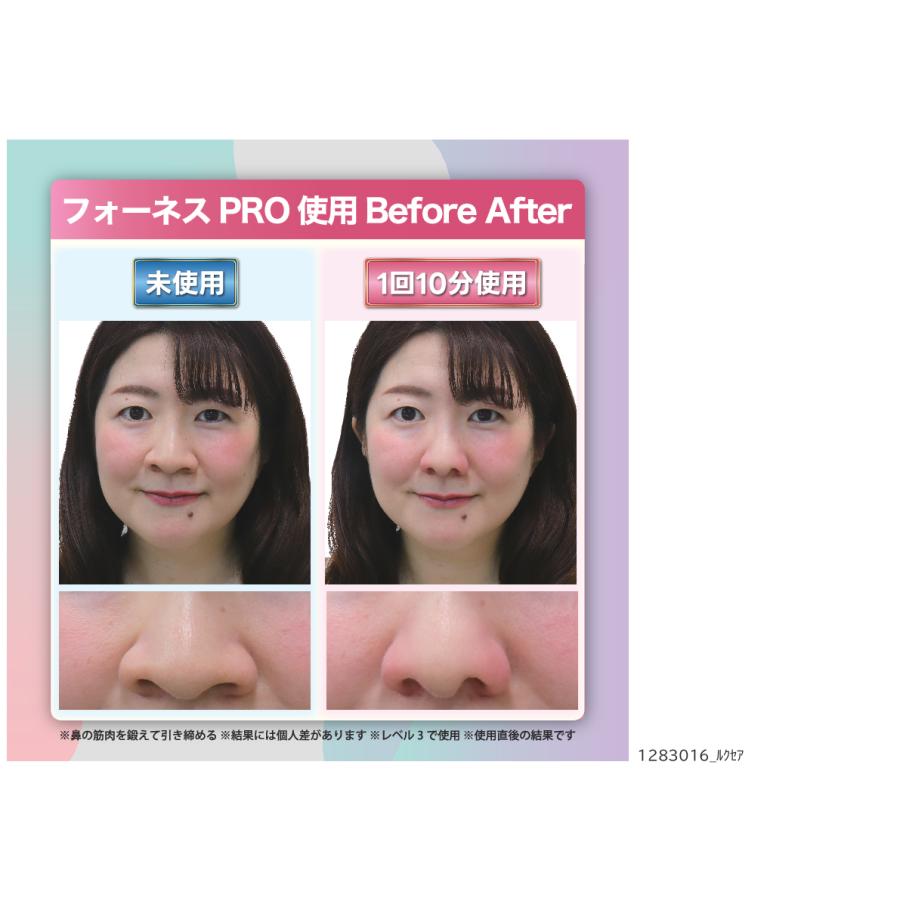 LUXCEAR（ルクセア） 鼻専用美顔器 ルクセアフォーネスPRO ルクセ