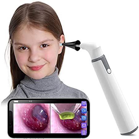 720P HD Wireless Ear Wax Removal Otoscope ScopeAround Ear Camera Wax Removal Ear Cleaning Camera with 6 Adjustable LED Lights Compatible with iPhone/Android Phone 