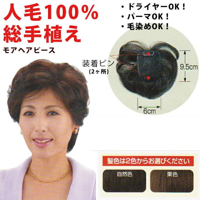 【送料無料※一部地域は除く】 モア　ヘアピースＭＨ-10　モアヘアピース　部分用かつら　ウィッグ |  | 01