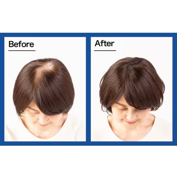 ルアン スーパーミリオンヘアー 20ｇ スーパーミリオンヘア  薄毛対策 増毛効果 テレビCMでおなじみの薄毛隠し クリスマス ギフトに プレゼントに |  | 04