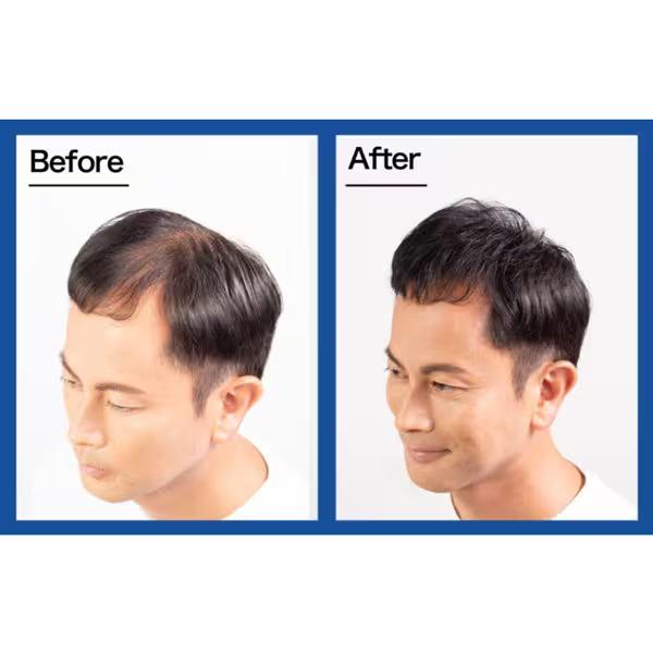 ルアン スーパーミリオンヘアー 30ｇ スーパーミリオンヘア  薄毛・抜け毛対策に！視覚的に増毛が可能なスーパーミリオンヘアー |  | 04