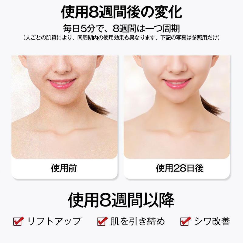 美顔ローラー EMS リフトアップ効果 美顔器 V顔 小顔ローラー 電動