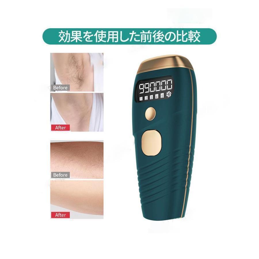 脱毛器 家庭用脱毛 脱毛機 永久 全身適用 氷感 99万発 男女兼用 5段階