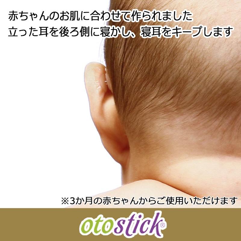 Otostick シリコンシール 赤ちゃん用 立ち耳 コップ耳 矯正 1セット Oto104 Shopping Mu 通販 Yahoo ショッピング
