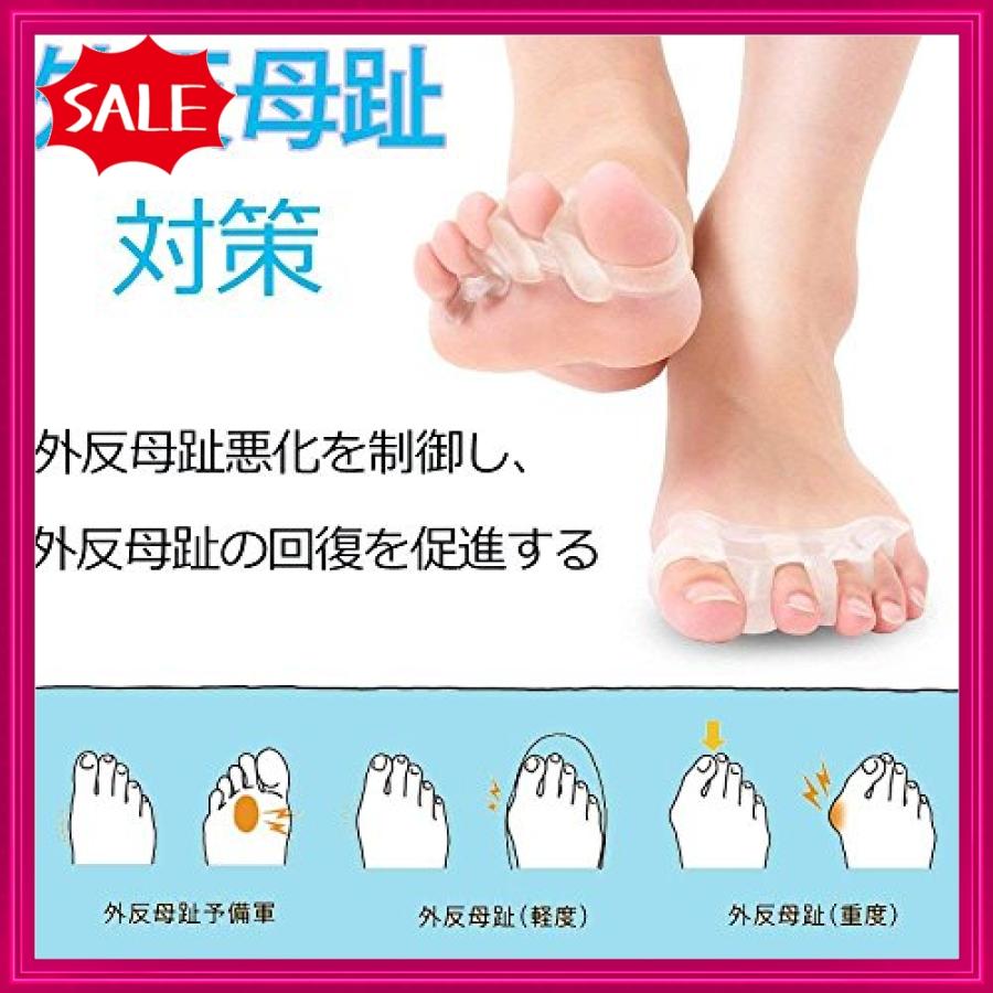 足指 広げる セパレーター 足指 サポーター Sukwii 浮き指 矯正グッズ あしゆびちゃん ないはんしょうし 矯正 5本 Rai ショップ山本 通販 Yahoo ショッピング