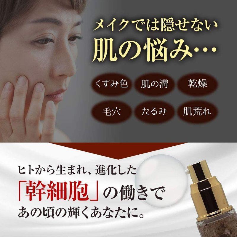 N2-ZERO 導入美容液 ヒト由来幹細胞培養上清液配合 エイジングケア ウイルス検査済 日本製 30ml