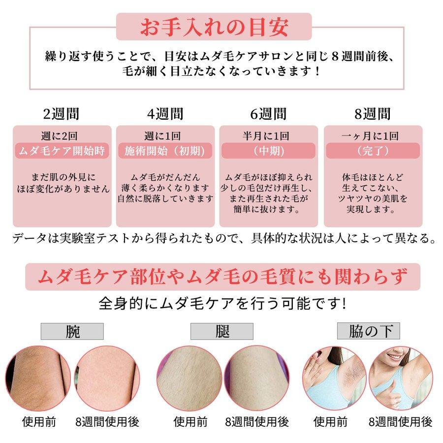 敏感肌用家庭用脱毛器 美容脱毛器 脱毛器 脱毛 美容 美容器 脱毛機 脱毛機 医療脱毛 |