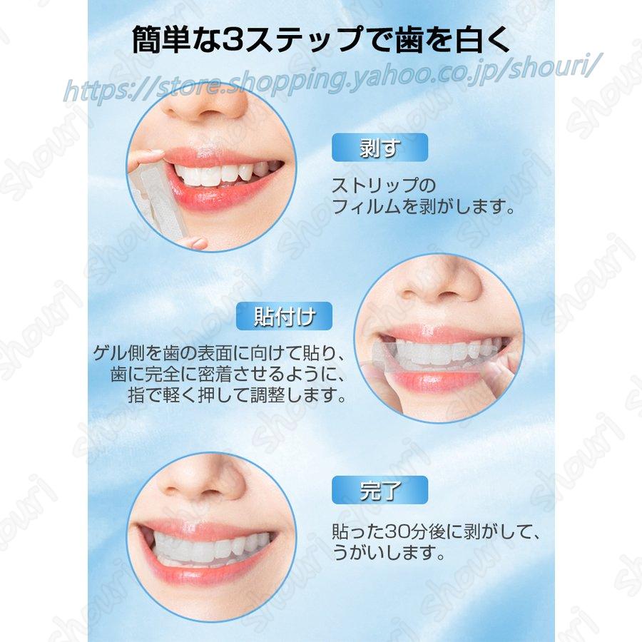 本格的にホームホワイトニングをするかたへ！クレスト ホワイトニング