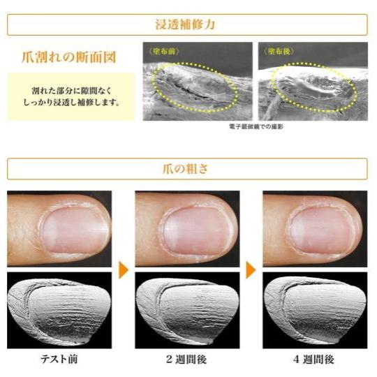 サトウ 【sato】 佐藤製薬 ネイル リペアセラム (ネイルエッセンス