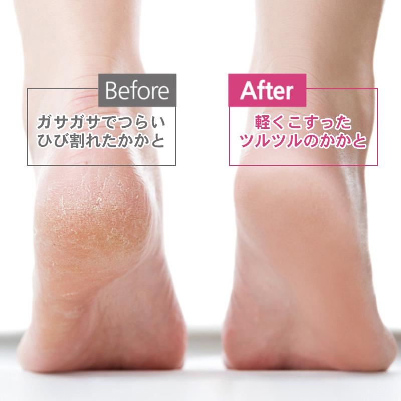 かかとケア かかと 角質 角質ケア フットケア 角質取り 角質除去 角質削り 足の角質取り 取り きれい 冬バーゲン かかと削り 足 ケア ガラス製 足裏 裏 足の裏