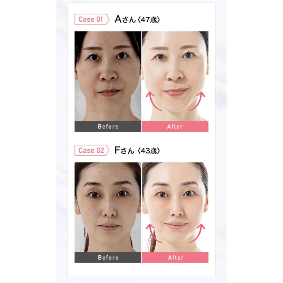 スキンアイロン SKIN IRON 正規代理店 美顔 美肌 温感ケア 首 スキンアイロン SKIN IRON 正規代理店 美顔 美肌 温感ケア 首