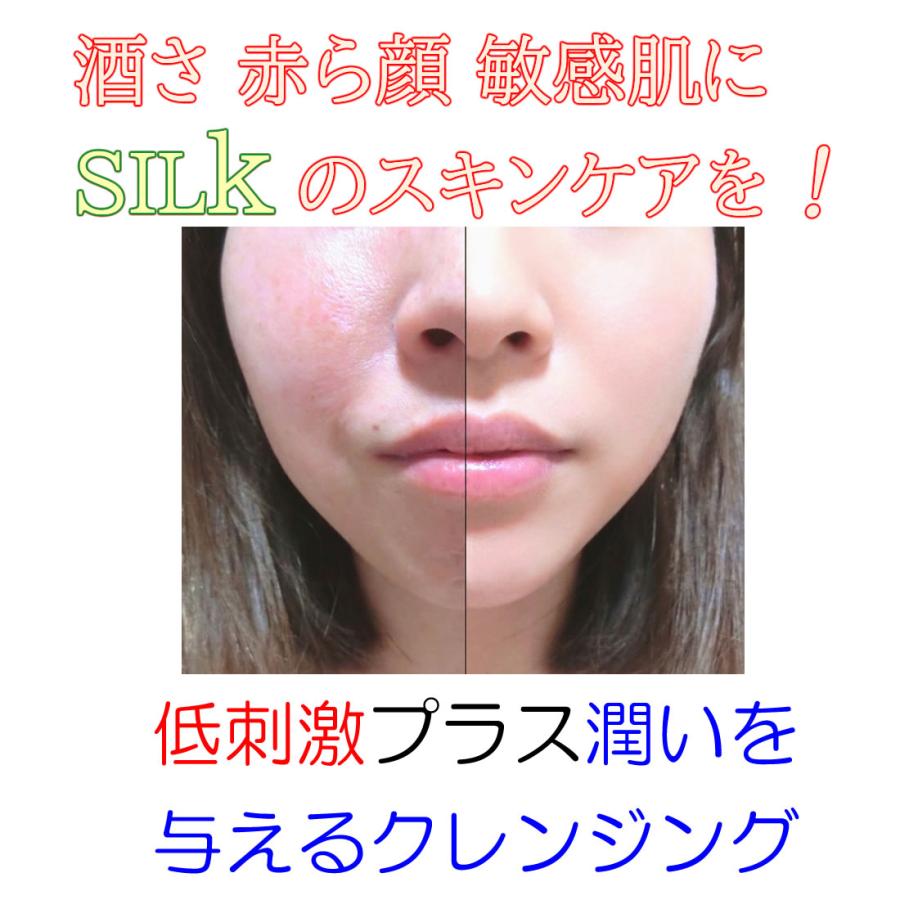 酒さ 赤ら顔 クレンジング 界面活性剤不使用 オイルフリー 保湿成分98