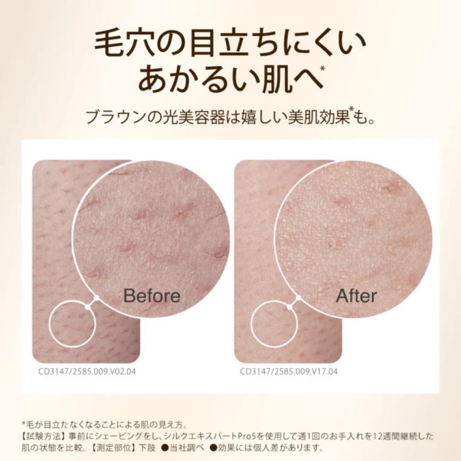 BRAUN シルクエキスパート Pro5 PL5158 脱毛器 ムダ毛 自宅 エステ 電動 アタッチメント シェーバー ブラウン (08) | BRAUN | 04