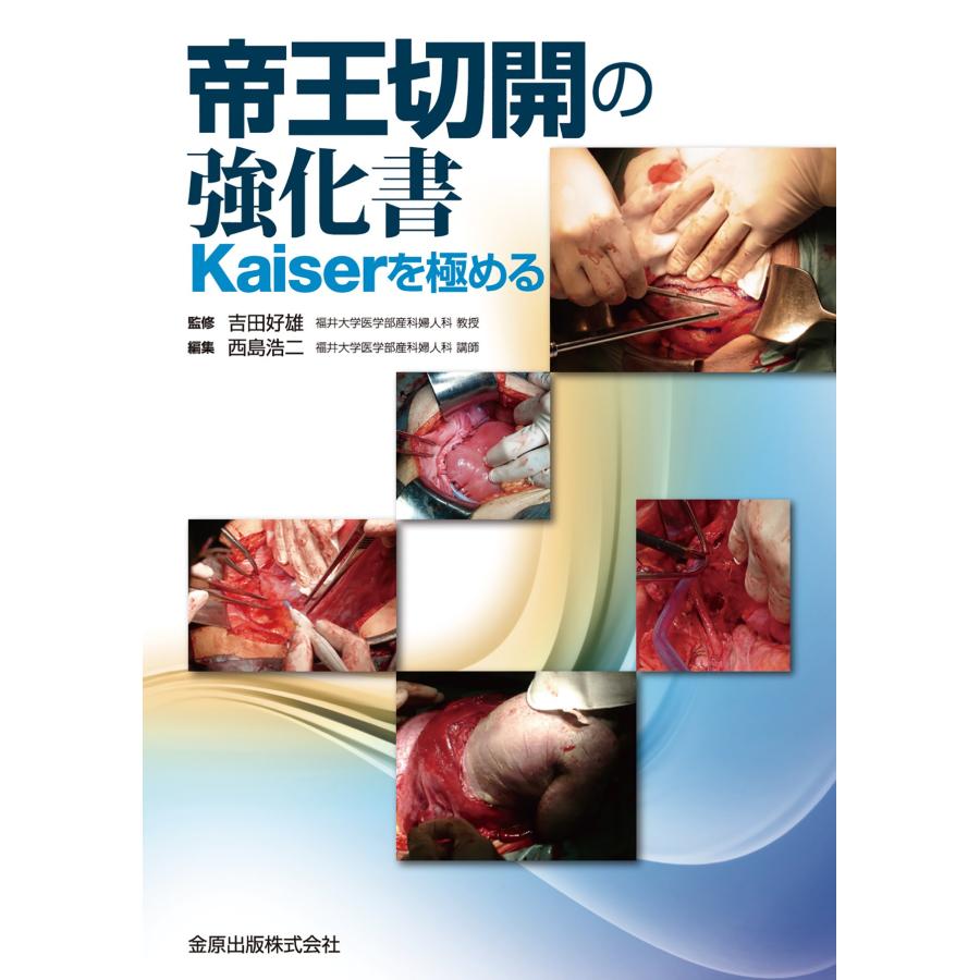 帝王切開の強化書 Kaiserを極める(中古品) | 
