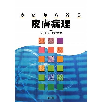 皮疹から診る皮膚病理(中古品) | 