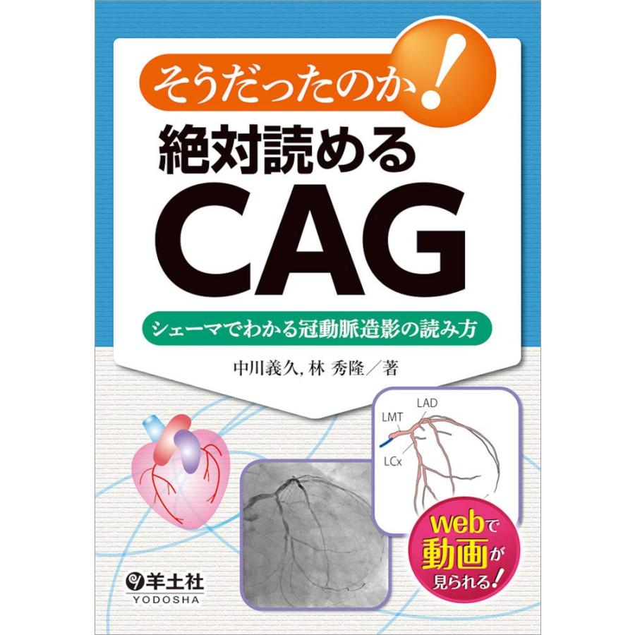 そうだったのか!絶対読めるCAG : シェーマでわかる冠動脈造影の読み方 - メルカリ そうだったのか!絶対読めるCAG : シェーマでわかる冠動脈造影の読み方