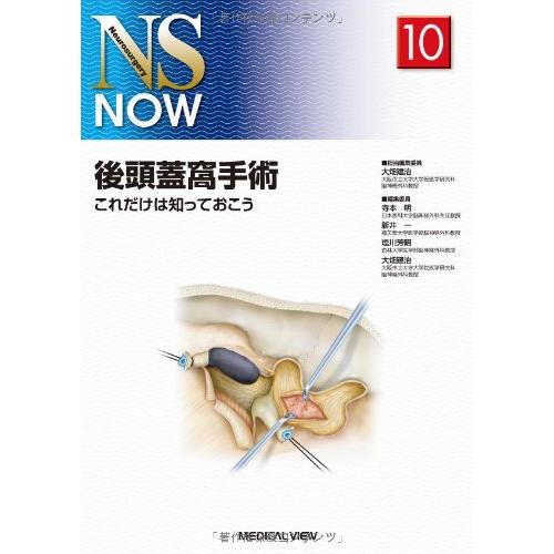 後頭蓋窩手術?これだけは知っておこう (NS NOW No.10) 後頭蓋窩手術?これだけは知っておこう (NS NOW No.10)(中古品