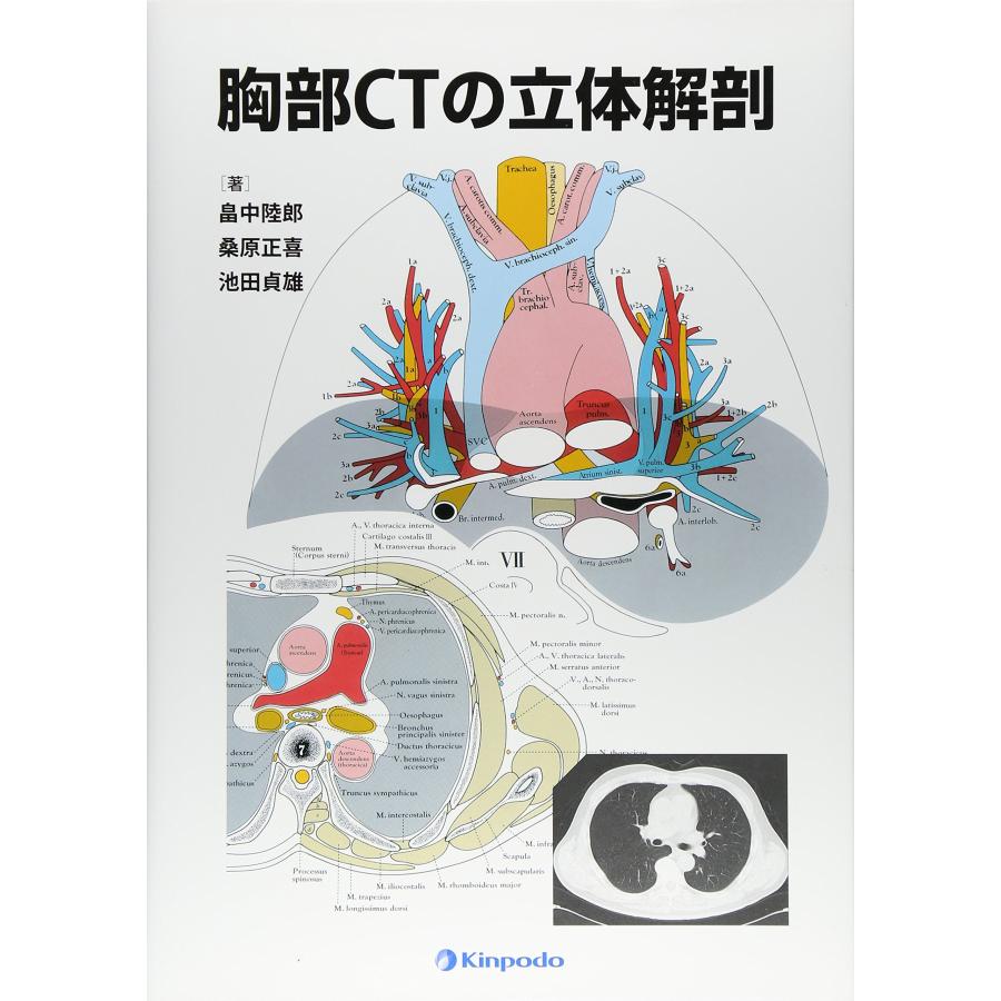 胸部CTの立体解剖(中古品) | 
