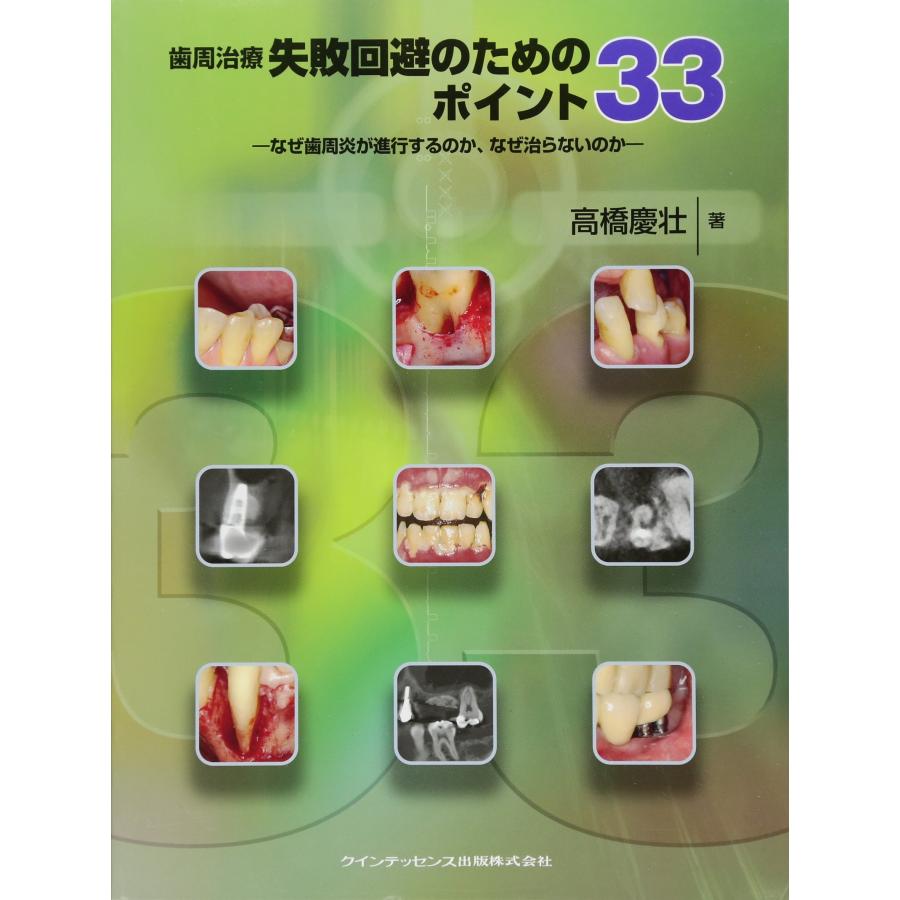 歯周治療 失敗回避のためのポイント33(中古品) | 