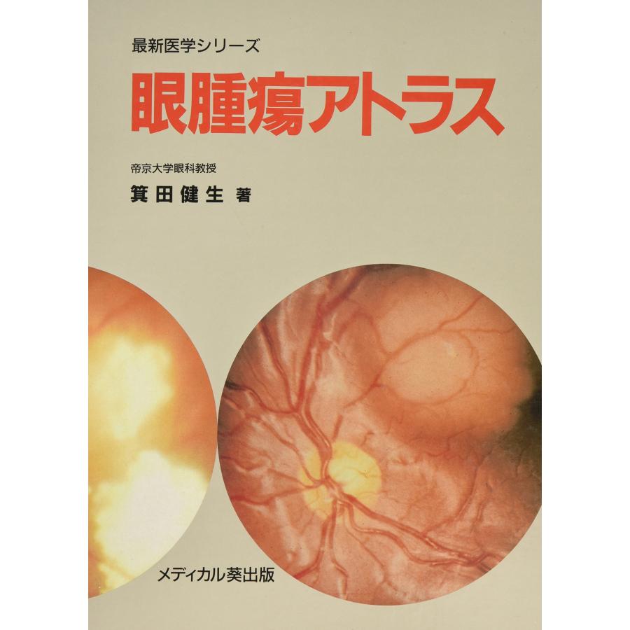 眼腫瘍アトラス (最新医学シリーズ)(中古品) | 