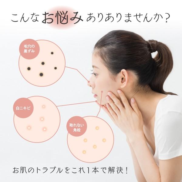 セールsale Off ニキビ 毛穴ケア 角栓 にゅるにゅる 取れる スキンケア フェイスケア 黒ずみ 皮脂汚れ 除去 いちご鼻 送料0円