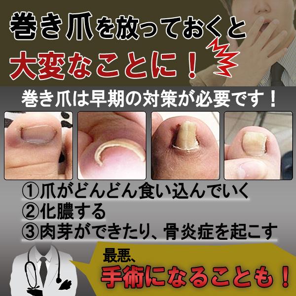 爪切り ニッパー 高級 匠の技 高齢者 ネイルケア 爪やすり ゾンデ 医療用 ヤスリ Tme Sincerity 通販 Yahoo ショッピング