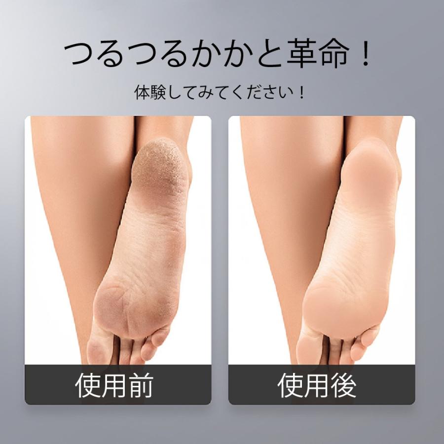 かかとケア ひび割れ がさがさ 角質除去 フットケア かかとすり かかとけずり 魚の目けずり かかとカッター 角質やすり 角質とり 角質削り 角質リムーバー |  | 09