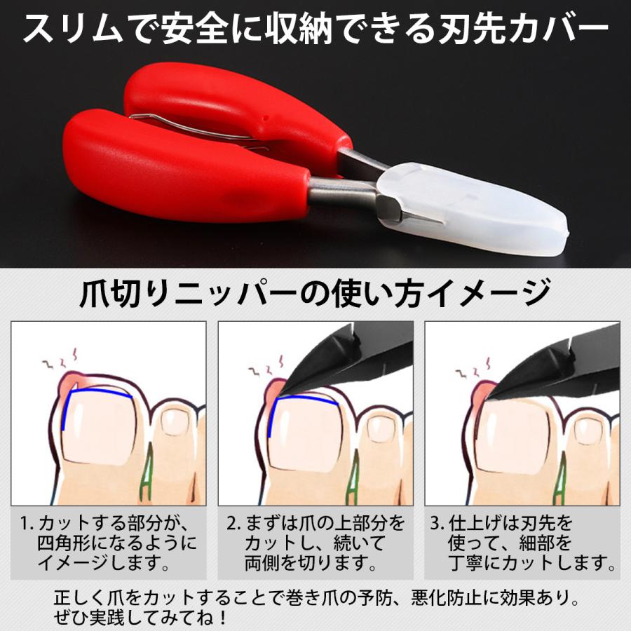 爪切り3点セット ニッパー やすり ゾンデ Abs樹脂 専用ケース巻き爪 硬い爪 爪やすり 爪用ゾンデ ステンレス製 切れ味抜群 Skh100 スコレーショップ 通販 Yahoo ショッピング