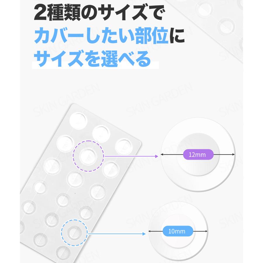 G9SKIN G9SKIN公式 即納 36枚入x2個セット 目立たない ニキビ G9SKIN G9SKIN公式 即納 36枚入x2個セット 目立たない ニキビ
