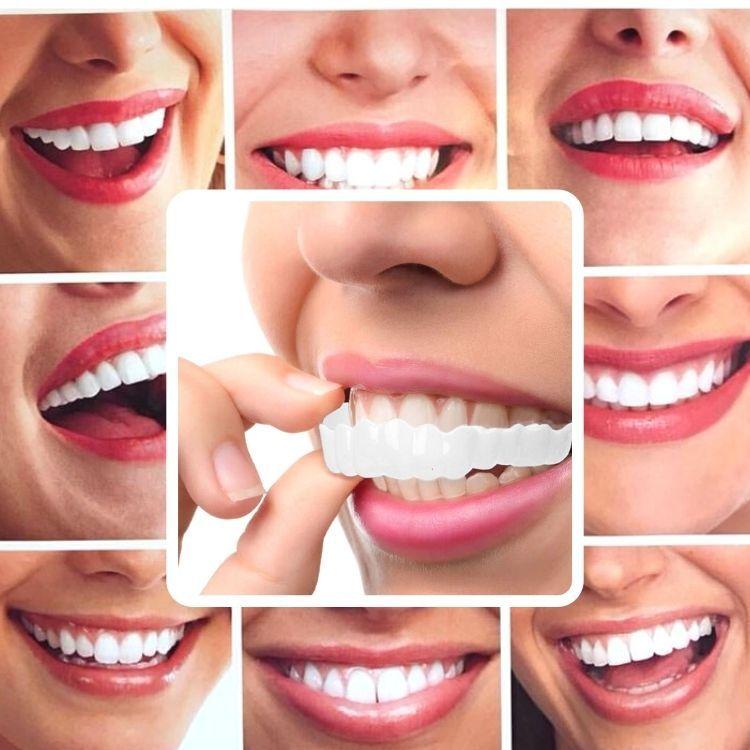 義歯カバー 上下用セット 入れ歯 仮歯などをカバーして全般的に白く