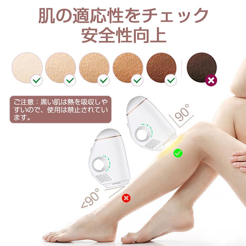 IPL光脱毛器 家庭用 光エステ 冷却技術 ワキ 腕 足 背中 ビキニライン