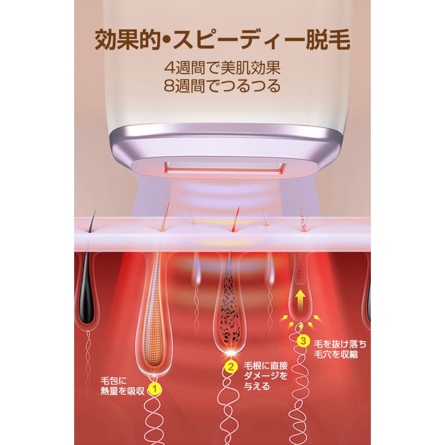 脱毛器 IPL光脱毛器 家庭用 光美容器 無痛脱毛 美肌機能 5段階調節 2