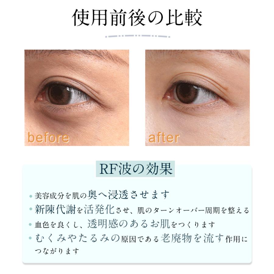 目元美顔器 RF ラジオ波 多機能 美顔器 EMS美容器 目元アンチ