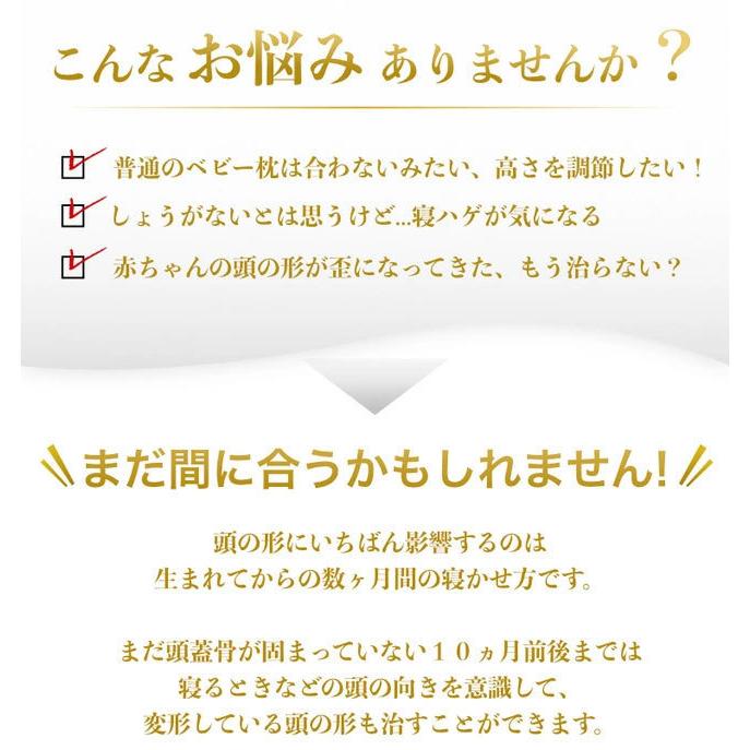 ドーナツ枕 Esmeralda ベビー枕 赤ちゃん ベビー 絶壁防止 向き癖 絶壁頭 エスメラルダ 柔らかい まくら 頭の形 Esm Dt 子供服と雑貨のスマイルベビー 通販 Yahoo ショッピング