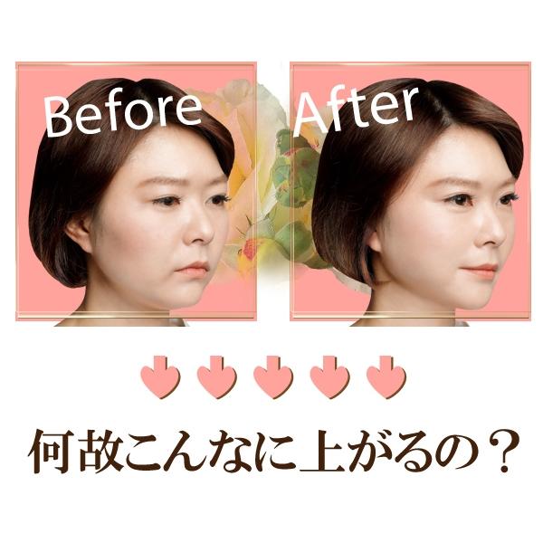 瞬間リフトアップ リフトアップバンド ほうれい線 たるみ しわ 小顔