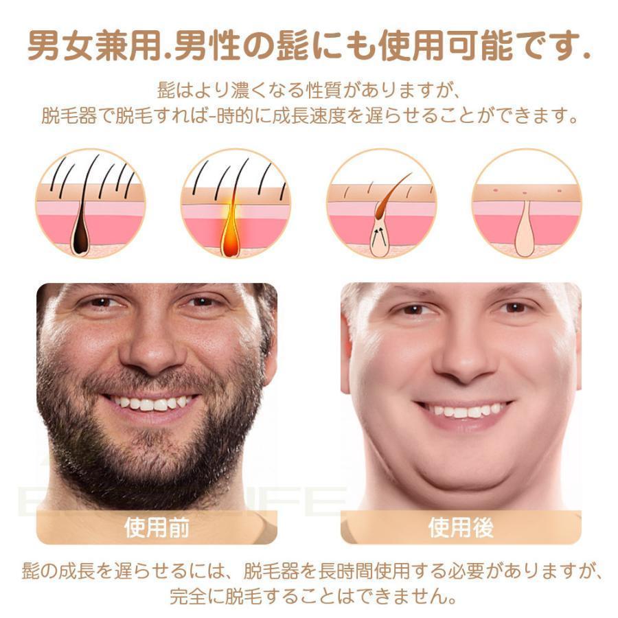 脱毛器 メンズ 髭 女性 vio対応 冷感 IPL光美容器 サロン級 ヒゲ ムダ