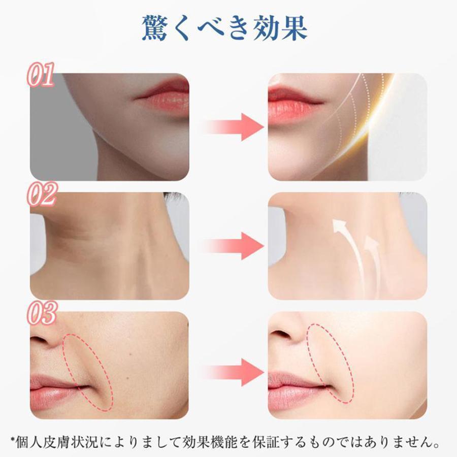 美顔ローラー ほうれい線 EMS ローラー コロコロ アクティブ 美顔器