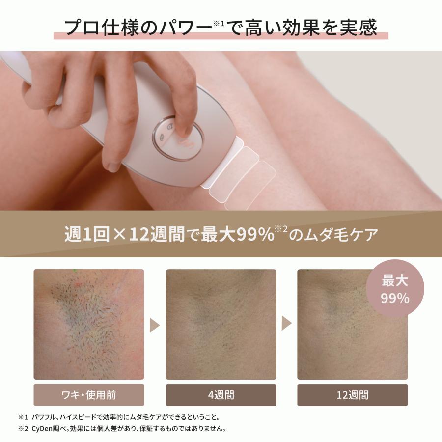 脱毛器 光美容器 全身脱毛 VIO対応 ヒゲ 顔 女性 男性 メンズ兼用 家庭