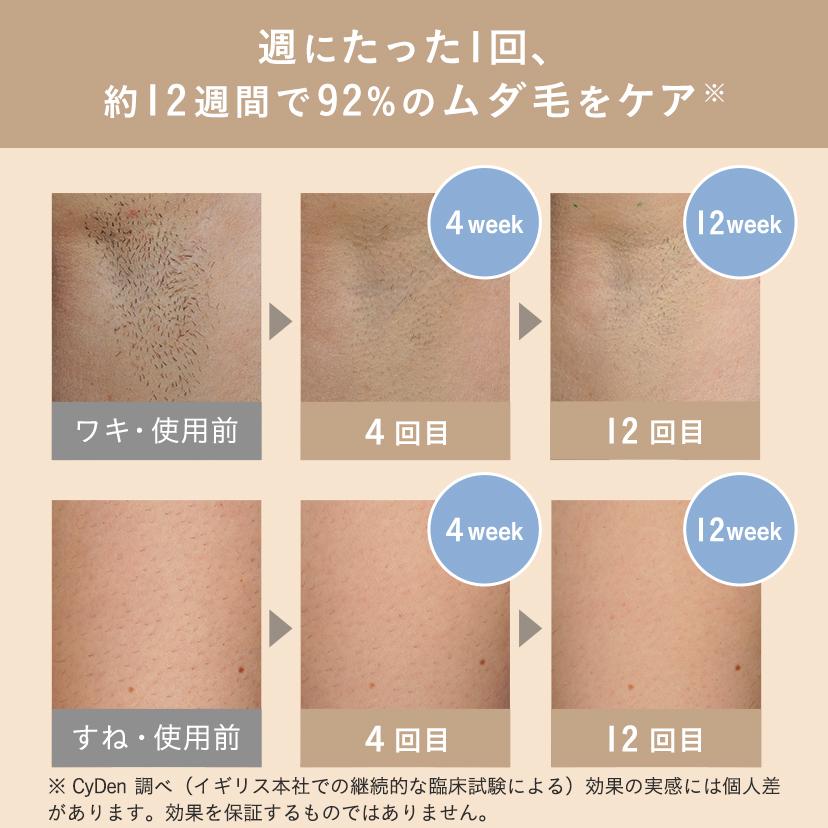 脱毛器 痛みレス コンパクト 可愛い 小型 軽量 Bare Pop ムダ毛 脱毛ケア 全身スピーディー脱毛 光脱毛器 脱毛 メンズ脱毛器 家庭用脱毛器 スムーズスキン公式の画像
