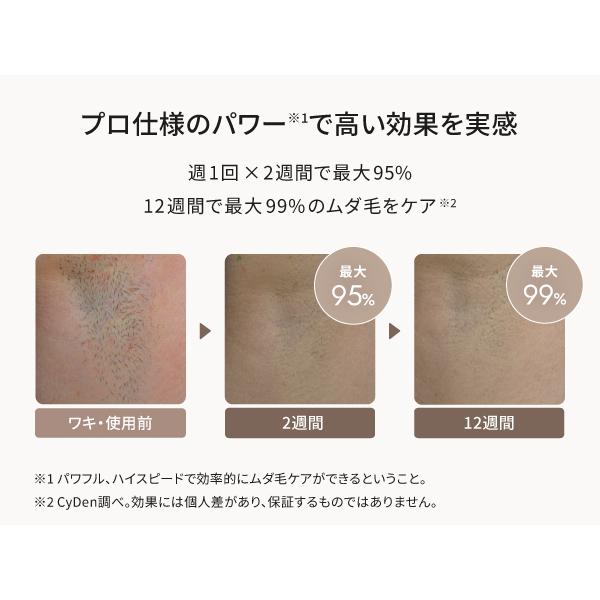 脱毛器 光美容器 全身脱毛 VIO対応 ヒゲ 顔 女性 男性 メンズ兼用 家庭