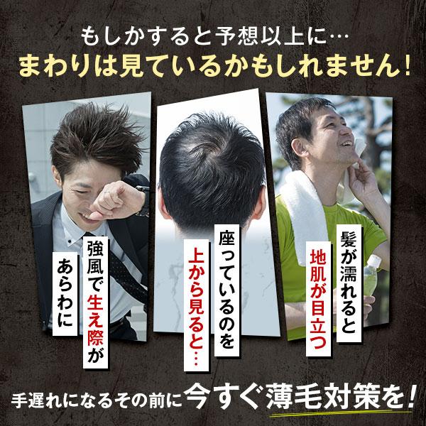 チャップアップ 公式 医薬部外品 育毛 ローション シャンプー チャップアップ 公式 医薬部外品 育毛 ローション シャンプー