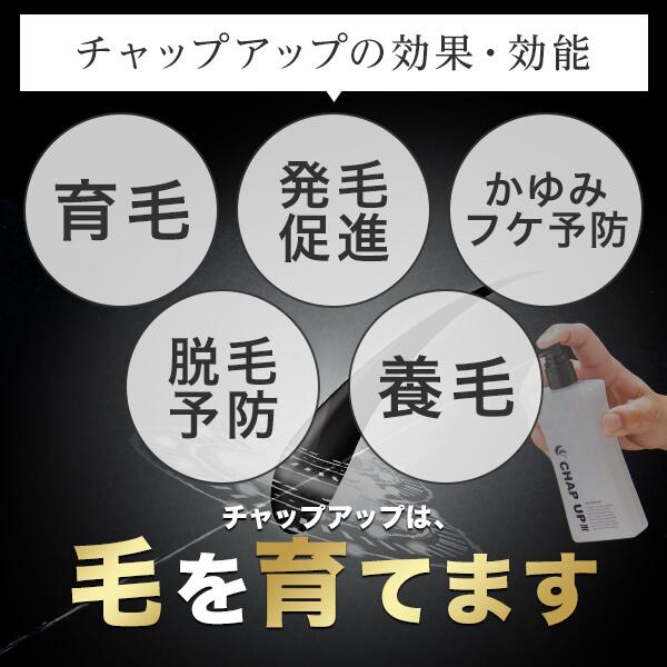 公式】 チャップアップ CHAP UP 医薬部外品 育毛 ローション 1本 育毛 公式】 チャップアップ CHAP UP 医薬部外品 育毛 ローション 1本 育毛