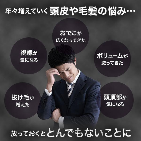 チャップアップ 「18%OFFで販売中」公式 医薬部外品 育毛 チャップアップ 「18%OFFで販売中」公式 医薬部外品 育毛
